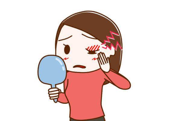 【医師監修】ものもらいは何が原因で起こる？自然治癒できるかや予防法を紹介